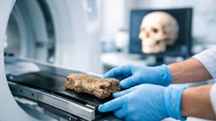 Chinchorro-Mumien im CT: Warum Schädelinnenvolumen und Körpergröße über Jahrtausende zunahmen