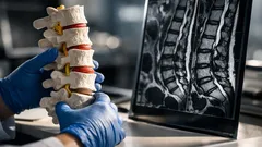 Bandscheibenregeneration bei Kreuzschmerzen: was die Forschung jetzt wirklich verändert